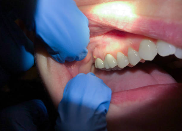 Best Broken or Cracked Tooth Emergency Dentist in Penhook, VA