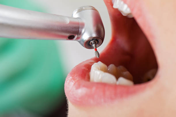 Best Emergency Dental Services for Seniors in Penhook, VA